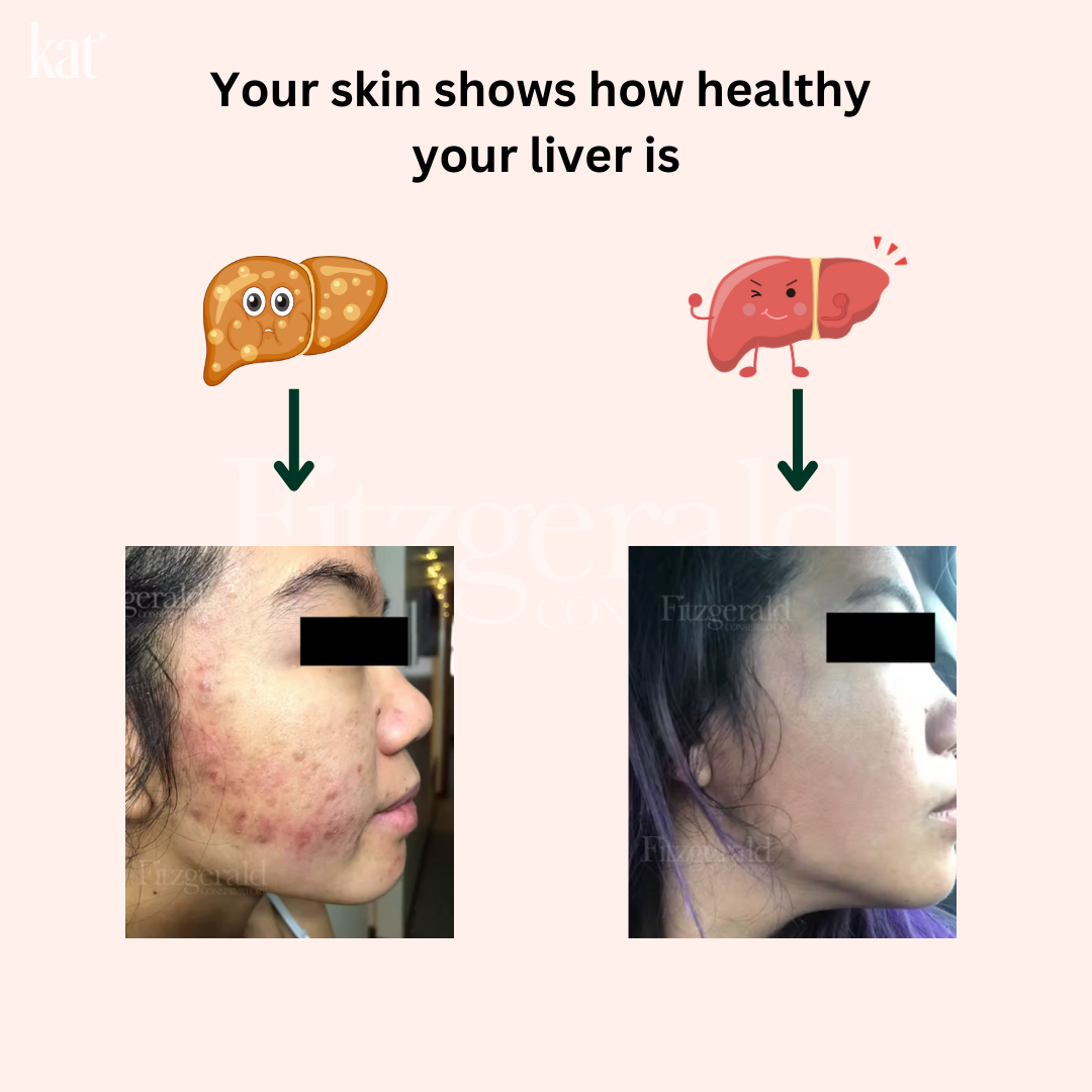 KAT Daily Skin + Liver Detox